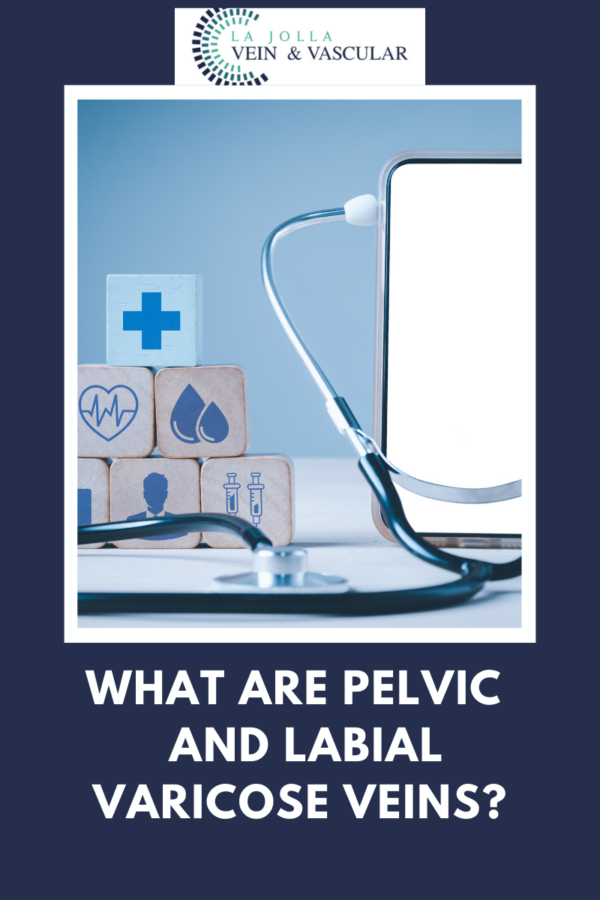 What Are Pelvic Labial Varicose Veins