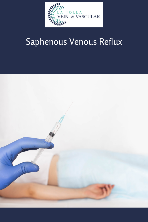 Vein Vascular Treatment Saphenous Vein Reflux