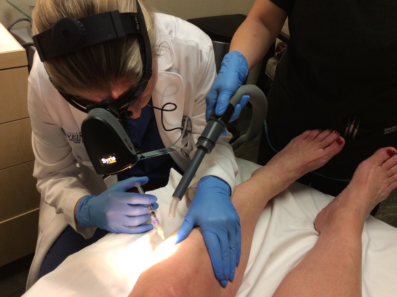 Anna Cardinell, La Jolla Vein Care Nurse Practitioner performing cryosclerotherapy treatment of spider veins.