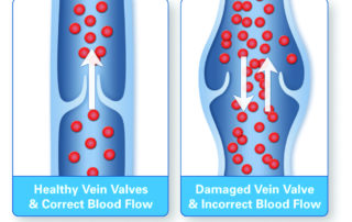 healthy_and_diseased_valves