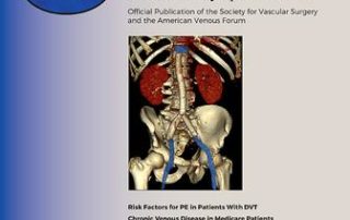 Vein Treatment During COVID-19 8 7be127414c4a83759633e33a8aa105f7-cover