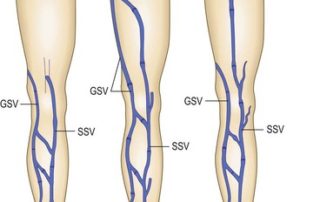 What's so great about the saphenous vein? 7 Great Saphenous vein and short saphenous vein