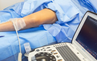 What Vein Treatment is Best for Me? 6 Microsoft Word - Laser.docx