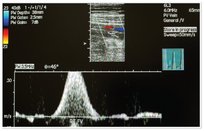 sample ultrasound image