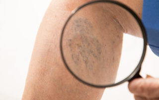 svmagnifying-glass-1030x687