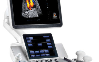 How Ultrasound Can Detect Hidden Dangers in Leg Veins Not Visible to the Naked Eye
