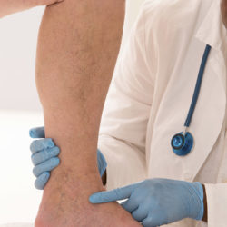 Follow-up Varicose Vein Ultrasounds and Clinic Appointments