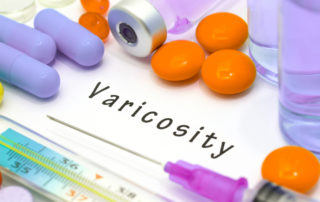 varicosity pills