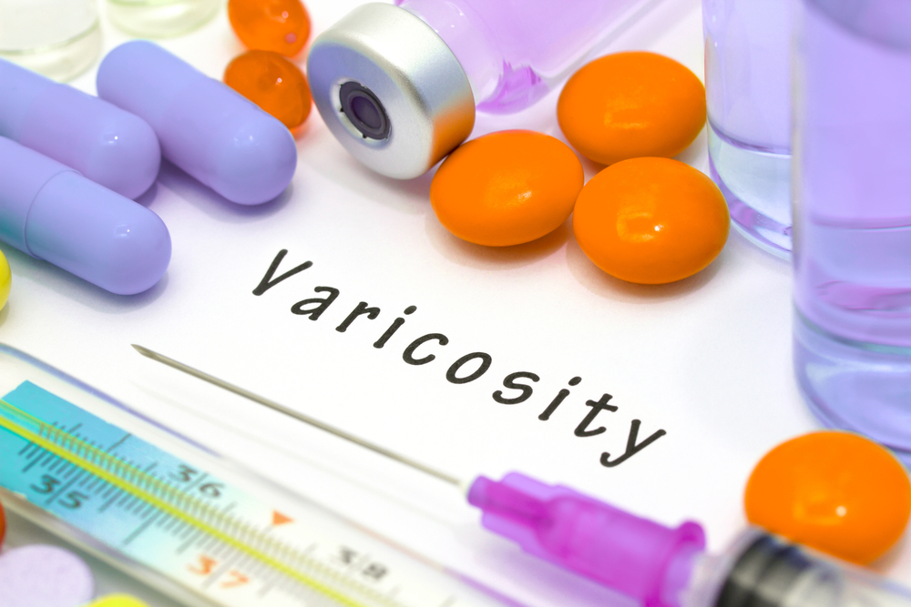 varicosity pills