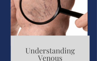 venous insufficiency