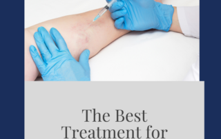 The best treatment for reticular veins