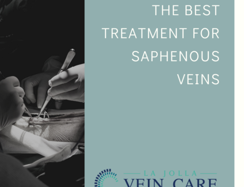 The Best Treatment for Saphenous Vein Reflux