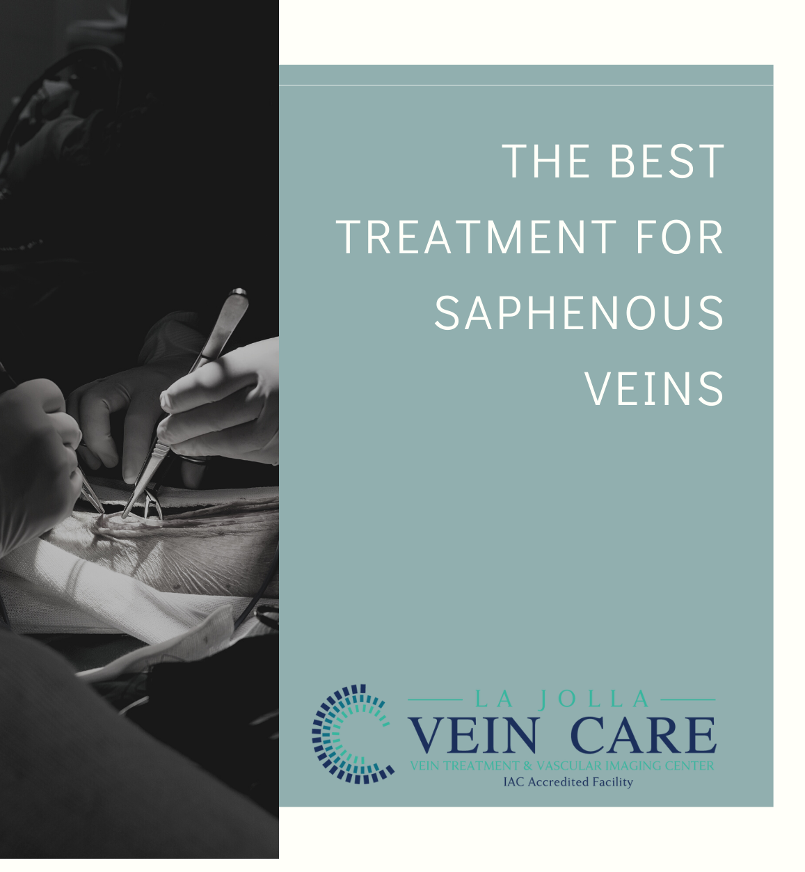 The best treatment for saphenous veins