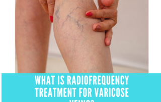 radiofrequencytreatment for varicose veins