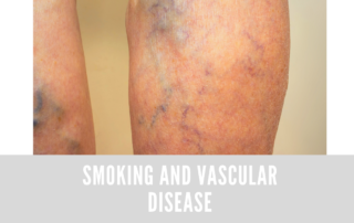 smokingvasculardisease