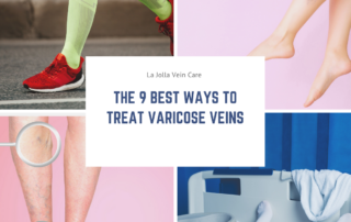 the 9 best ways to treat varicose veins