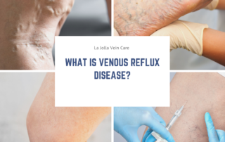 venousrefluxdisease