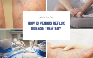 venous reflux