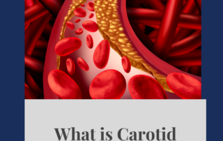 carotidarterydisease