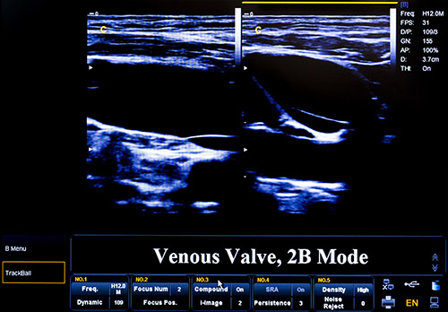 dup3 duplexultrasound