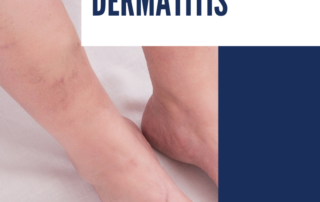 Venous Stasis Dermatitis