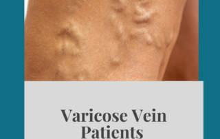 varicoseveinbeforeandafter