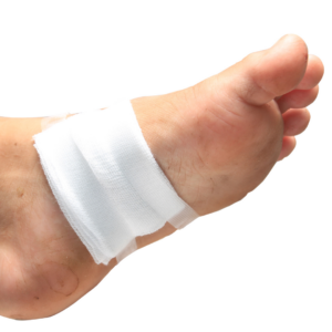 foot ulcer2