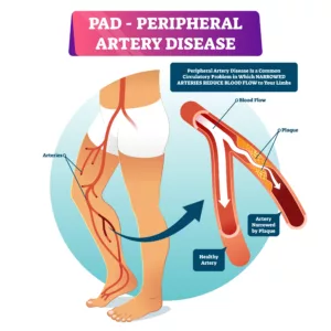 peripheral artery