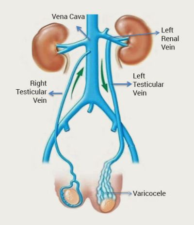 vena-cava-400×464