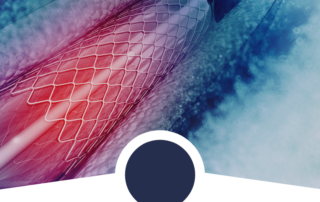 angioplasty