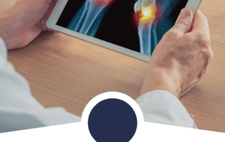 osteoarthritis