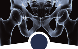 Pelvicvenouscongestion