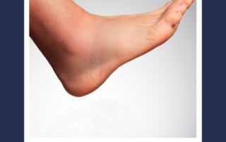 swelling