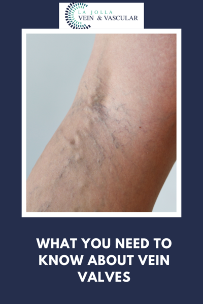 What you need to know about vein valves