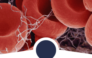 blood clot