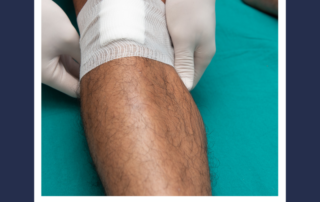 leg ulcer
