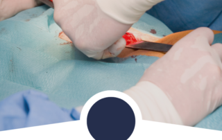 hernia