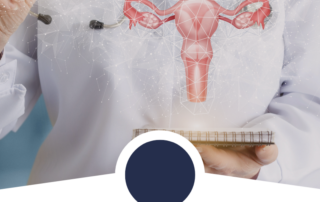 fibroids