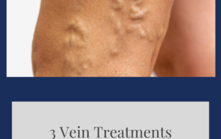 vein treatments