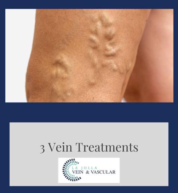 Vein Vascular Treatment