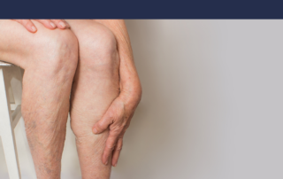 vein disease