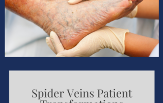 spider vein
