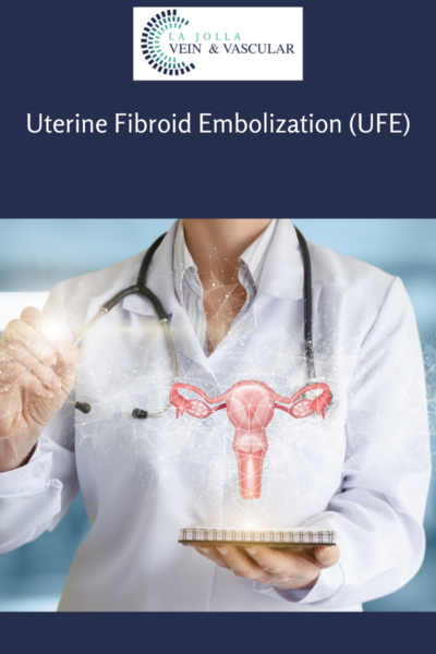 Uterine Fibroid Embolization Vein And Vascular Treatment