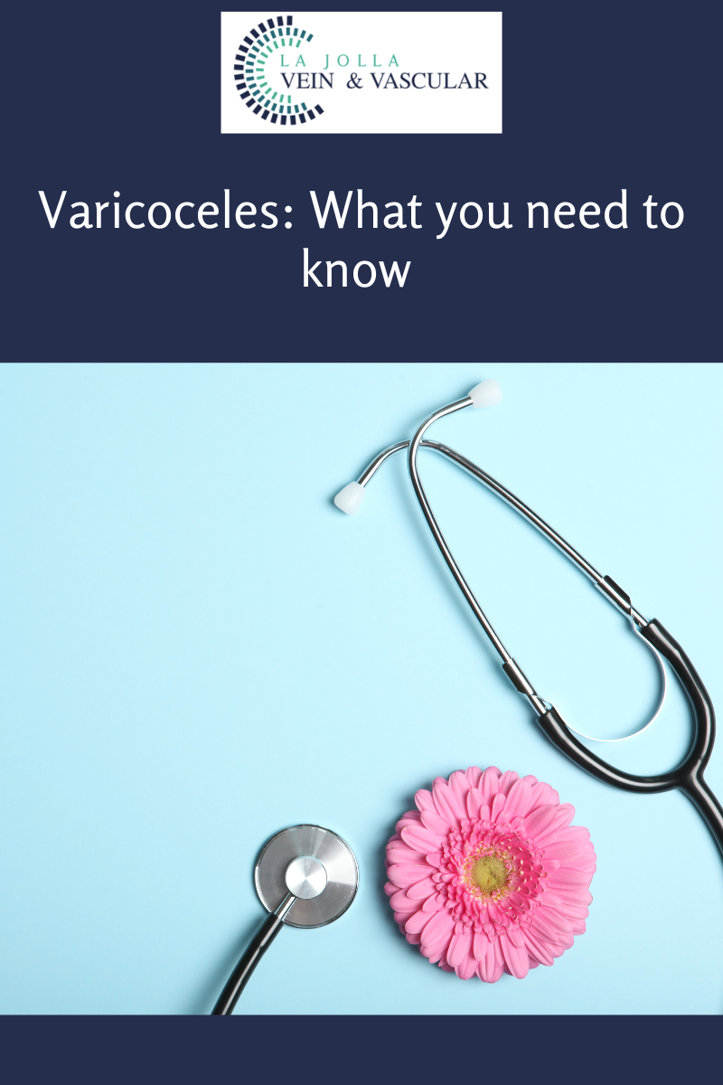 varicoceles
