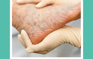 venous