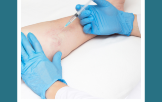 vein