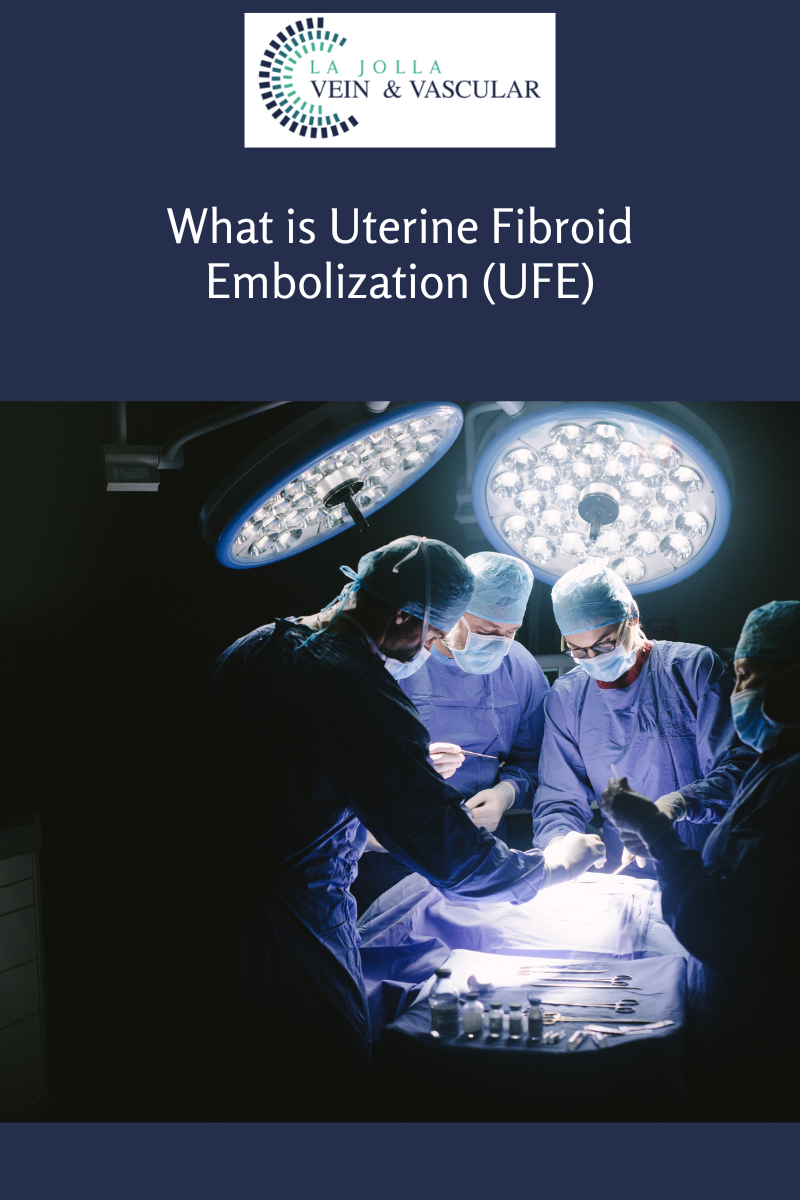 What is Uterine Fibroid Embolization