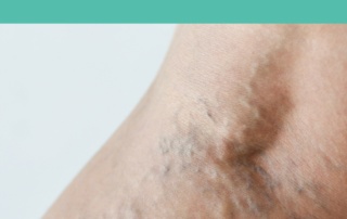 venous