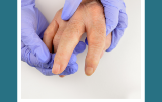 osteoarthritis
