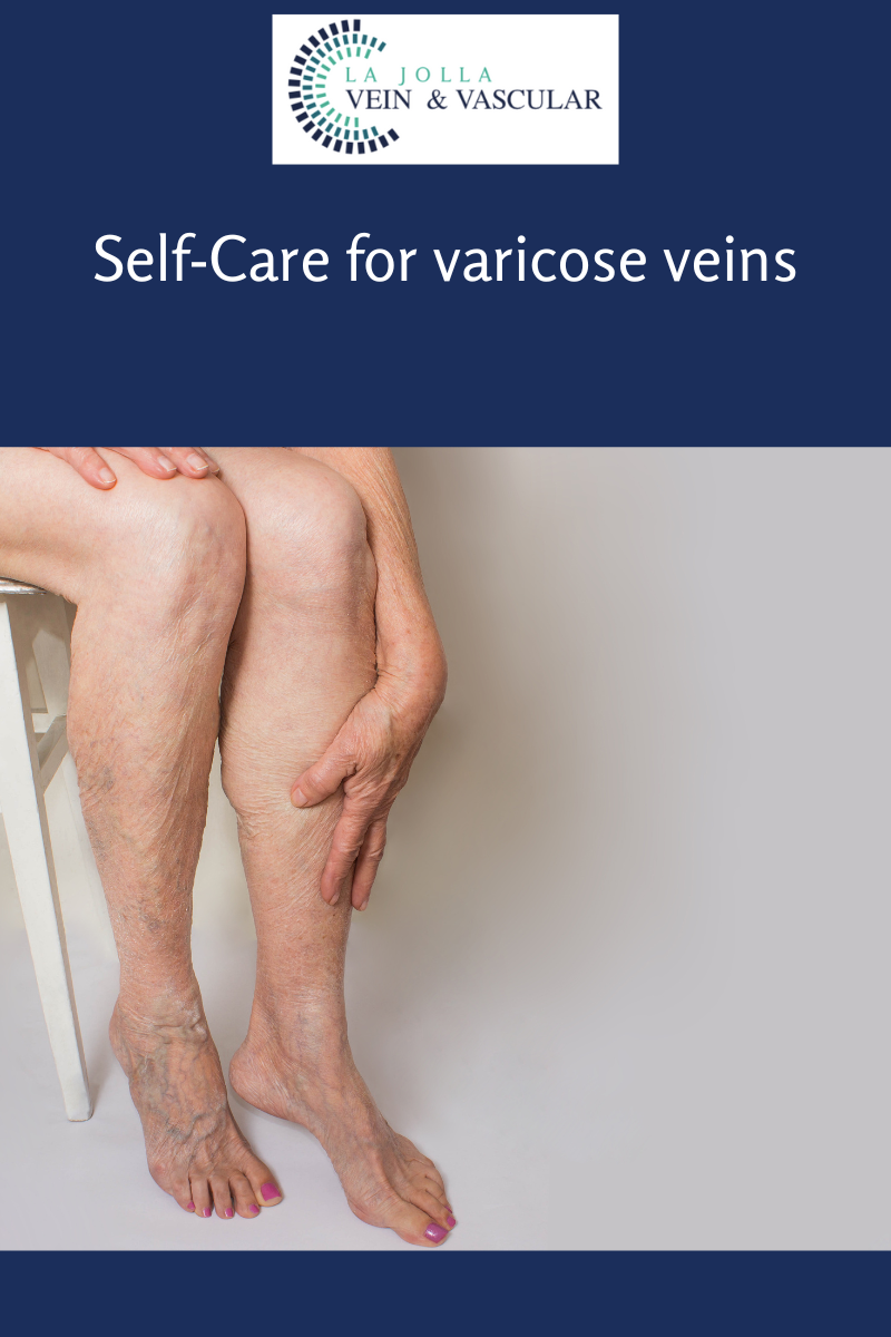 Varicose Vein & Vascular Treatment